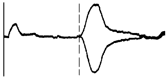 電纜終端開(kāi)路與短路脈沖反射波形比較